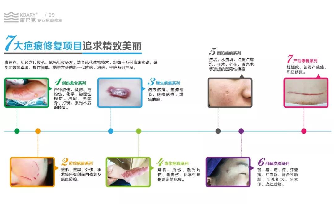 西宁疤痕修复加盟修复项目，重塑美丽肌肤，焕发自信光彩