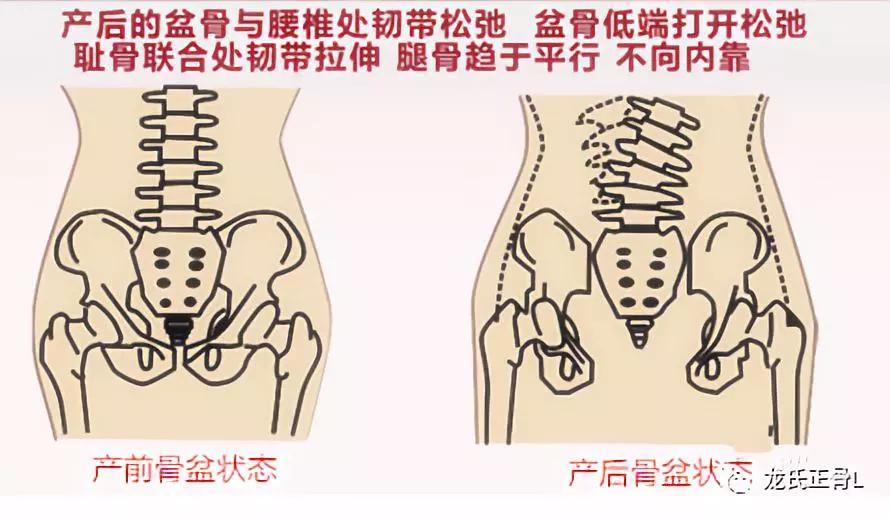 产后盆底肌项目加盟，商机与策略