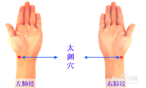 深圳穴位贴敷加盟项目，开启中医养生新时代