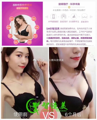 广西美体丰胸加盟项目，实现你的美体梦想