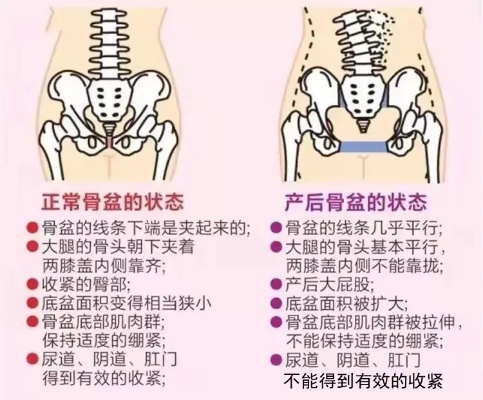 宣城产后骨盆恢复加盟项目，重塑美丽，自信归来