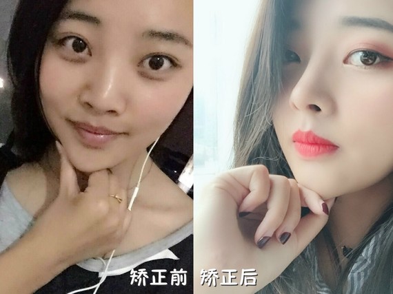 鼻子为什么会歪 人死鼻子为什么会歪