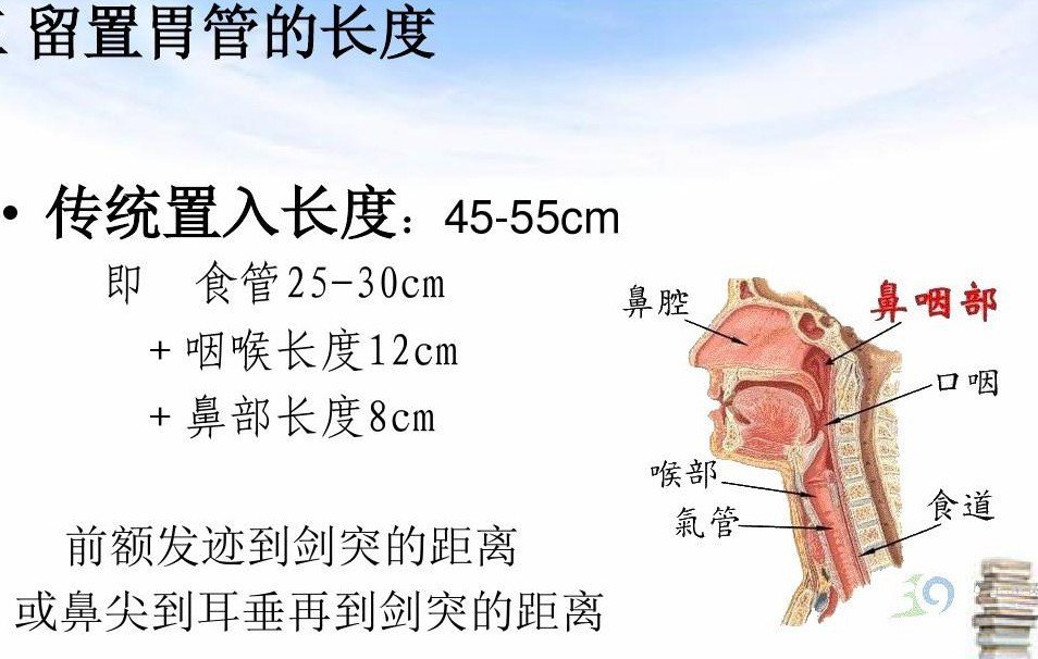 胃管为什么会盘在口腔 胃管为什么会盘在口腔上面