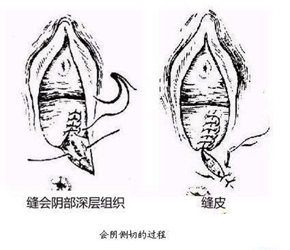 舟山顺产后恢复怎么样 舟山顺产后恢复怎么样的医院