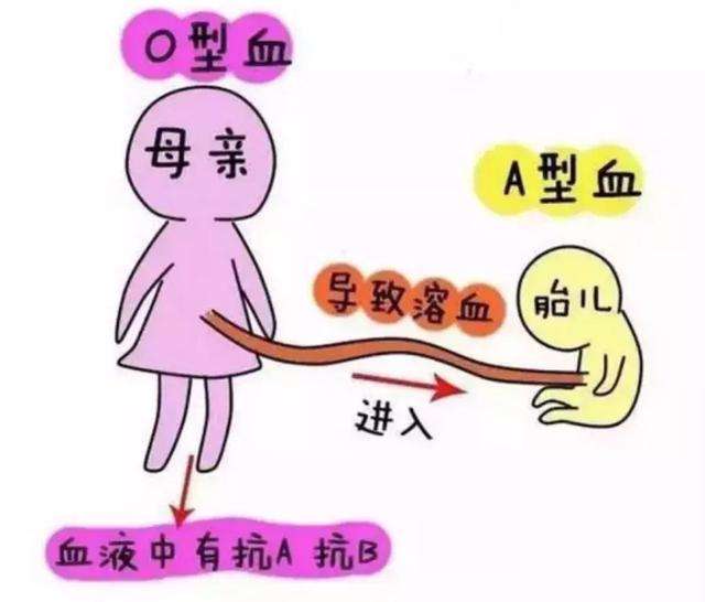 夫妻怎么测血型合不合(夫妻血型不合做什么检查)