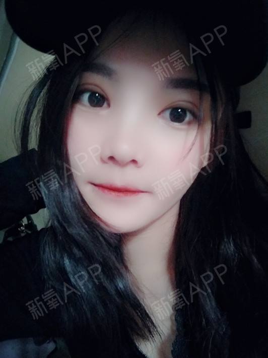 割双眼皮与运势(割双眼皮影响婚姻财运)