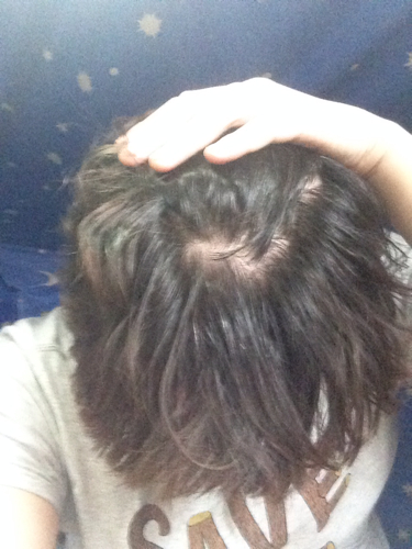 早白发运势(白发影响运势吗)